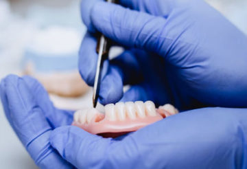 Implant dentaire